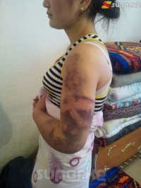 Жалал-Абадда катуу сабалган 17 жаштагы Назбийке Ош шаарындагы кризистик борборго которулду