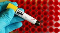 Өлкөдө ВИЧ жугузган адамдардын саны 2 айда 117ге өстү