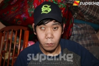 Көрүү мүмкүнчүлүгүнөн ажыраган Жайлообек Талип уулу эки көзүнө операция жасатууга Москвага жөнөп кетти