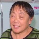 Кытайлык аялдын мурдунун ичине тиш өсүп чыгып аны дарыгерлер операция жолу менен алышкан