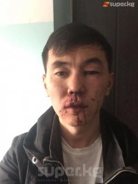 Бишкекте "тамашоучуну" сабаган" деген шек менен 8 бала кармалды