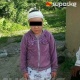 8 жаштагы кыздын башына жасалган операциядан кийин көзү көрбөй калды