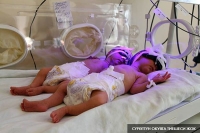 Бишкекте эгиз төрөп каза болгон 26 жаштагы келиндин денесин экспертизадан өткөрүүгө ата-энеси каршы болду