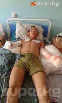 Башкы штаб: "Эки колу кесилген жоокерге салынуучу протездер алынып келе элек"