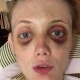 "Ал оозума акчаны салып, сабады". Орусиялык модель Кира Фокс күйөөсүнөн зомбулук көргөнүн айтып чыкты
