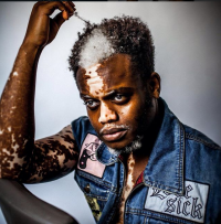 Ала оорусу модель болууга түрткөн жигит өзүнүн келбети менен сыймыктанат