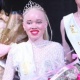 Зимбабведе "Эң сулуу альбинос айым" сынагынын жеңүүчүсү аныкталды