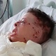 АКШда коңшусуна жардамга келген аял күйүүчү май чачып өрттөлдү