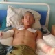 Эки колунан ажыраган жоокердин абалы оор болууда. Ага жардам берүүнү каалагандарга эсеп ачылды