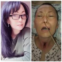 Төрөт учурунда инсульт алып, мурду менен тамактанып калган келин үйгө чыгарылды. Жакындары үйдө анын абалы оорлошуп жатканын айтат