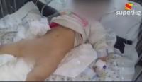 Жалал-Абадда оор абалда жаткан 2 жашар кыздын ден соолугунда жылыш болгон жок. Апасы эртең Орусиядан келиши мүмкүн