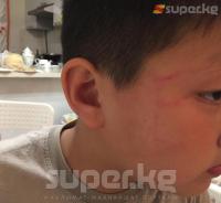 Шаар тургуну: "Эки баламды урган адам жазасыз жүрөт. Балдарымдын баш мээси чайкалып, биринин кулагынын тарсылдагы жарылып кеткен"