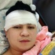 Ырчы Алмаз Шаадаевдин башына операция жасалды