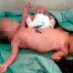 Индияда сиам эгиздери эки буту жана төрт колу менен төрөлдү