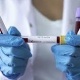 Ухан вирусу: Дүйнөдө коронавирус инфекциясын жуктуруп алгандардын саны 42 миллиондон ашты