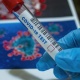 Ухан вирусу: Дүйнөдө коронавирус инфекциясын жуктуруп алгандардын саны 42 миллион 532 миң 198ге жетти