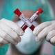 Ухан вирусу: Дүйнөдө коронавирус инфекциясын жуктуруп алгандардын саны 43 миллионго жакындады