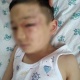 Жактоочу: "Сокулукта катуу сабалган 6 жаштагы баланын апасы күйөөсүнө карата тосмо арыз жазды"