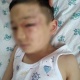 Сокулукта сабалган 6 жашар бала. Баланын жактоочусу тергөөчүлөргө карата арыз жазды