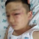 Чүйдө аёосуз сабалган 6 жашар баланын окуясы: Билдирүү түшөрү менен дароо чара көрбөгөн кызматкерлерге тартиптик жаза берилди