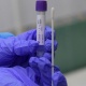 Өзбекстанда коронавирус менен ооругандардын саны 342ге жетти