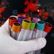 Сингапурдук изилдөөчүлөр Кыргыз өлкөсүндө коронавирустун жайылуусу качан токтой турганын айтышты