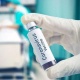 Дүйнөлүк саламаттыкты сактоо уюму коронавируска каршы вакцина 1 жылга жетпей иштелип чыгаарын айтууда