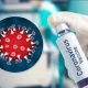 Коронавируска каршы вакцина чыкса, биринчилерден болуп аны АКШ алабы?