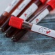Казакстанда коронавируска кабылгандардын саны жалпы 6 миңге чукулдады