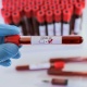 Казакстанда коронавирус менен ооругандардын жалпы саны 8 миңден ашты