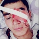 Чек арадагы чырдан жаракат алган баланын атасы: "Ооруканада жаткан 4 адамдын бири менин уулум. Бир баланын моюнуна орок менен сайышыптыр, анын абалы оор"