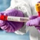 Өлкөдө бир суткада 37 адамдан коронавирус аныкталды. Анын көбү Бишкектен. Жалпы сан 1936га жетти
