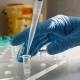 "Ухан вирусу": Коронавирустан айыккандардын саны 3 миллиондон ашты
