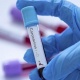 Бир суткада 22 медицина кызматкери коронавирус жуктуруп алды