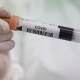 Өзбекстанда коронавирус жуктургандардын саны 17 миң 755ке жетти