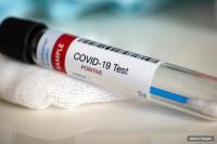 +967. Өлкөдө COVID-19 жана пневмония илдетинен жабыркагандар 30 миңден ашты