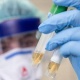 Коңшу Өзбекстанда коронавирус жуктуруп алгандардын саны 18 миң 703кө жетти