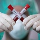 Өлкөдө бир суткада коронавирус жана пневмониядан 9 адам каза болду