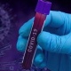 Өзбекстанда коронавирус жуктуруп алгандардын саны 37 миңге жакындады