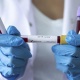 Казакстанда коронавирус жуктуруп алгандардын саны 105 миңден ашты