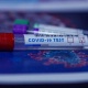 Коңшу Казакстанда өткөн суткада 45 адамдан коронавирус илдети аныкталды