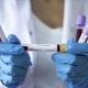 Өлкөдө өткөн суткада 166 адам коронавирус илдетинен айыгып чыкты