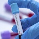 23-январдан тарта өлкөгө авиатранспорт аркылуу келген Кыргыз жарандарынын ПЦР-анализи терс чыккан маалымдамалары милдеттүү түрдө болушу керек