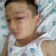 Сокулукта 6 жашар баланын сабалышы: Сот өгөй атаны баланын дарыланууга кеткен чыгымын төлөп берүүгө милдеттендирди