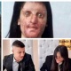 "Эми терисин тирүүлөй сыйрыйт". Түркияда кыз ага кислота чачкан адамга турмушка чыкты