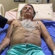 Бразилиянын президенти 10 күн бою токтоосуз ыктытуудан кийин ооруканага жаткырылды