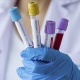 Коронавирус инфекциясы менен ооругандардын саны өткөн айга салыштырмалуу 2,4 эсеге көбөйдү