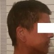 Чүйдө бычактан жаракат алган эркек киши ооруканада каза болду. Шектүү кармалып камакка алынды