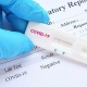 COVID-19: Кыргызстанда акыркы жумада 77 жаңы учур аныкталды