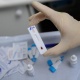 Ошто ВИЧти текшерген экспресс тесттерди акысыз берген тестоматтар орнотулат
